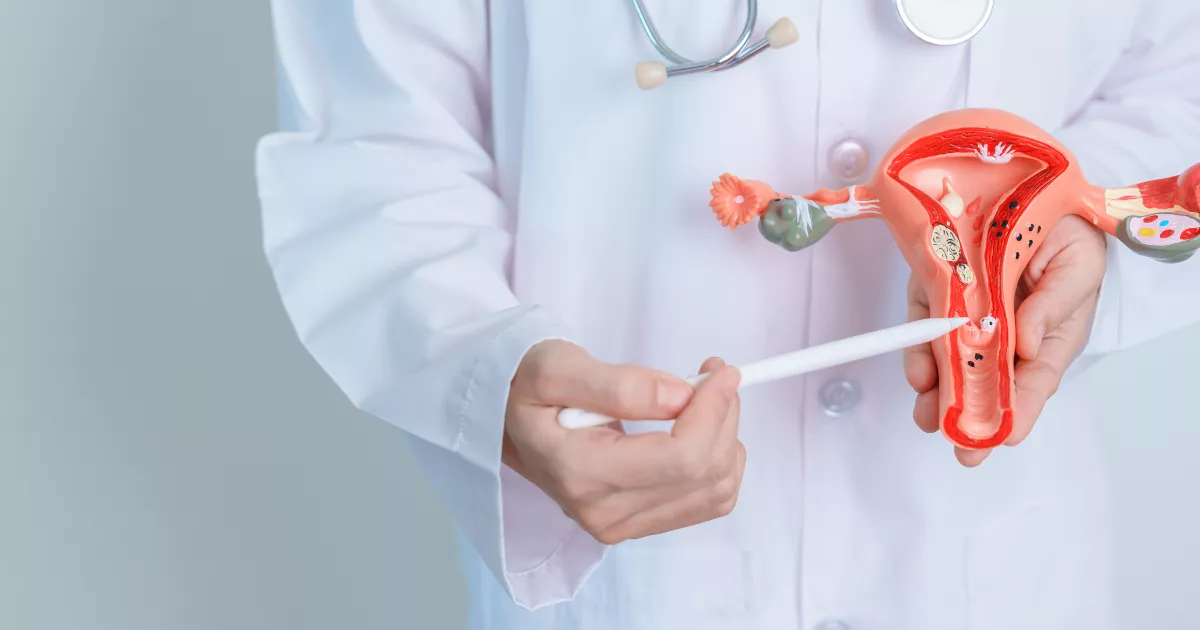 The Four Types of Fibroids