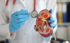 Understanding How Your CKD Progression Is Measured